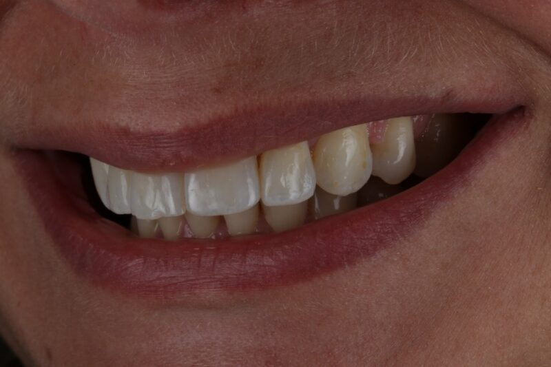 After - Cheadle Hulme Dental