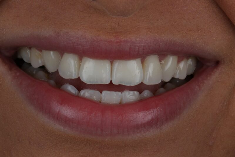 After - Cheadle Hulme Dental