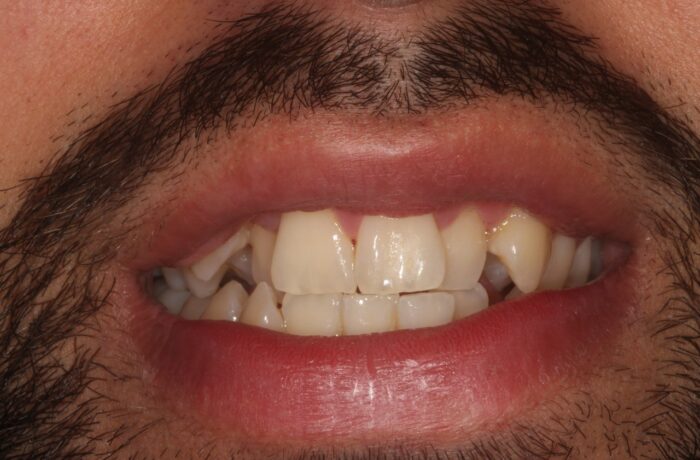 Before - Cheadle Hulme Dental