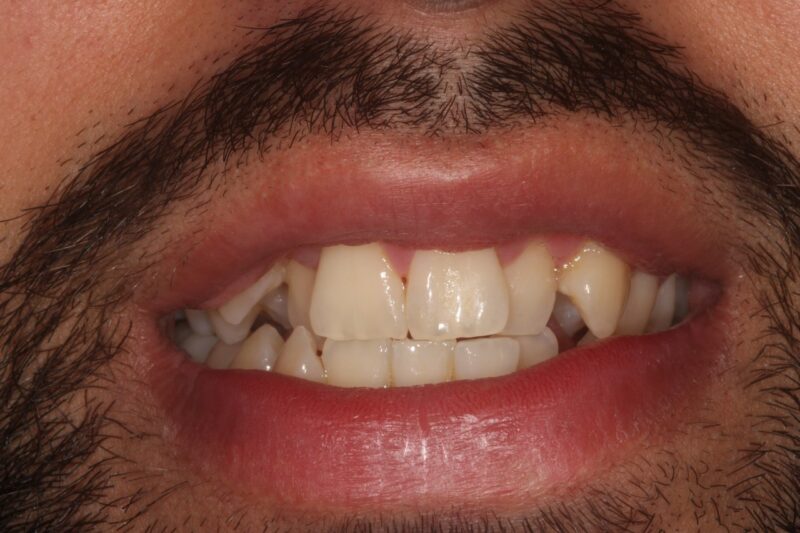 Before - Cheadle Hulme Dental