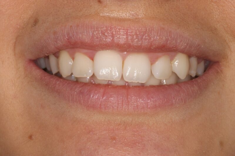 Before - Cheadle Hulme Dental