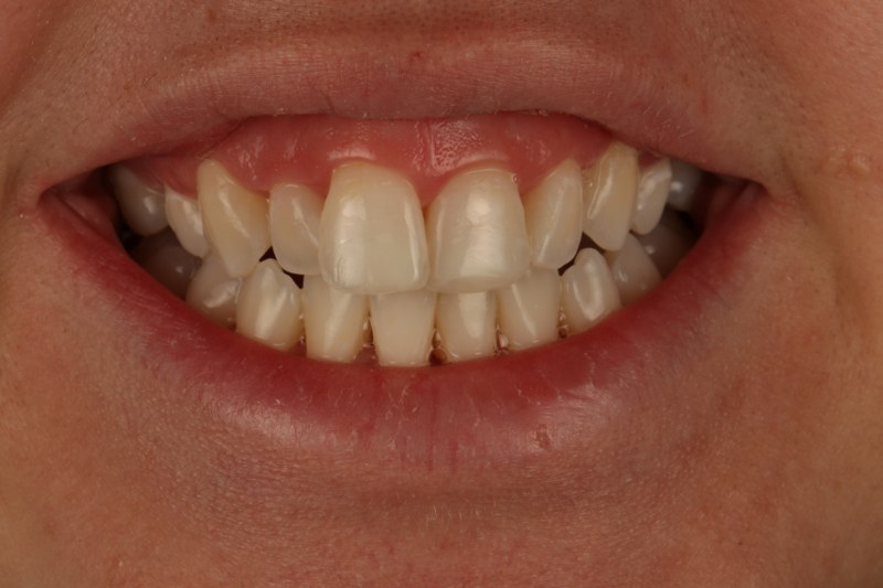 After - Cheadle Hulme Dental