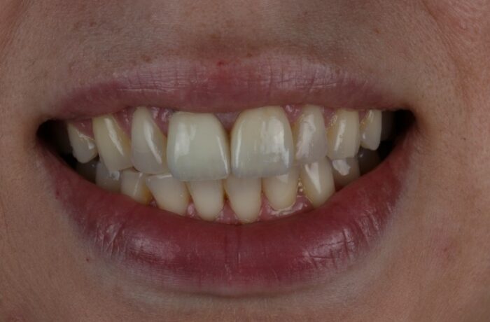 After - Cheadle Hulme Dental