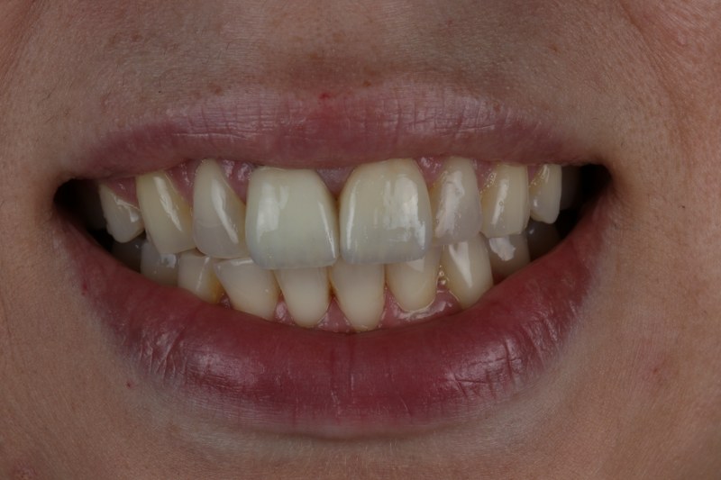 After - Cheadle Hulme Dental