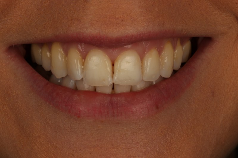 After - Cheadle Hulme Dental