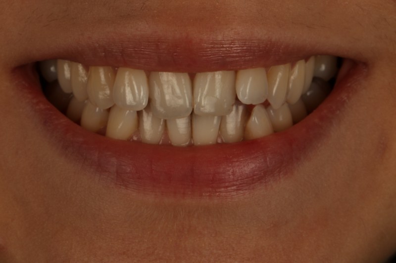 Before - Cheadle Hulme Dental