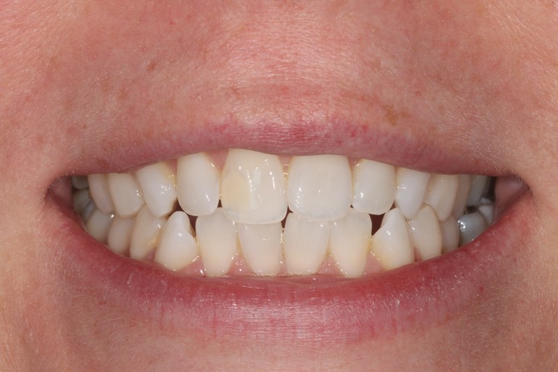 Before - Cheadle Hulme Dental