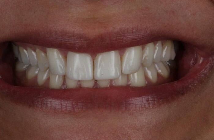 After - Cheadle Hulme Dental