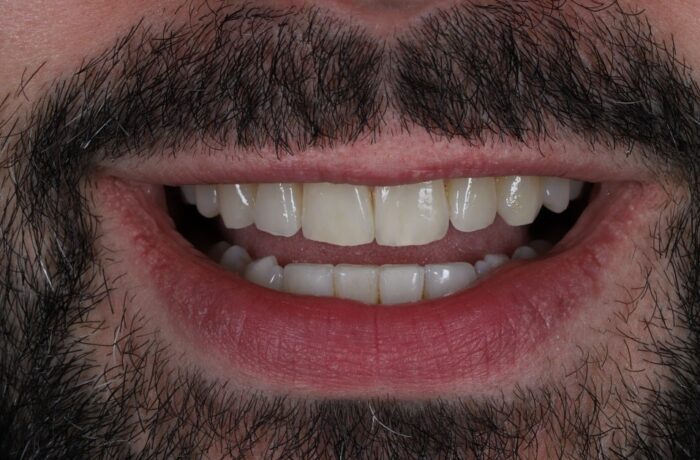 After - Cheadle Hulme Dental