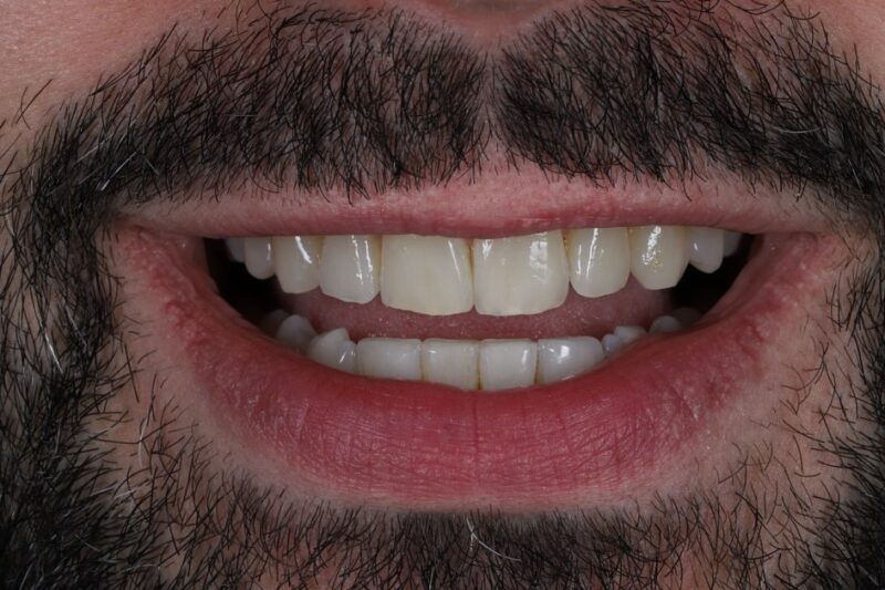 After - Cheadle Hulme Dental