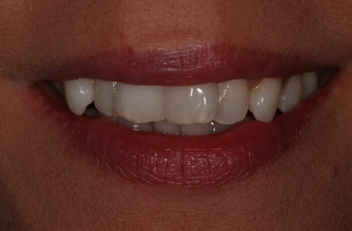 Before - Cheadle Hulme Dental