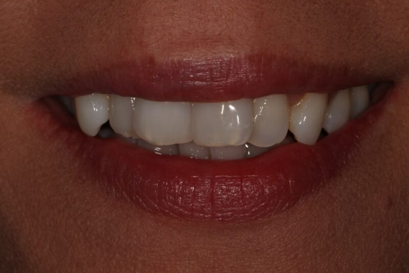 Before - Cheadle Hulme Dental