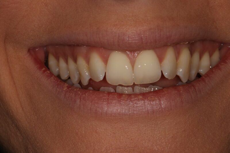 Before - Cheadle Hulme Dental