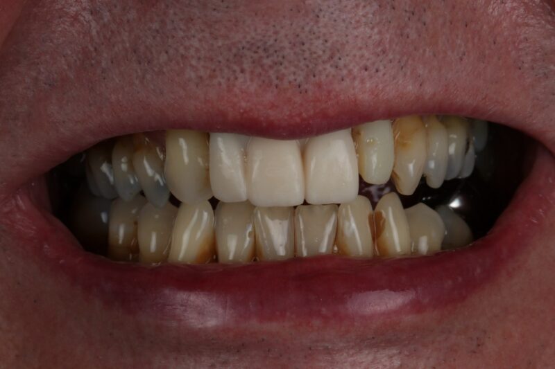 Before - Cheadle Hulme Dental