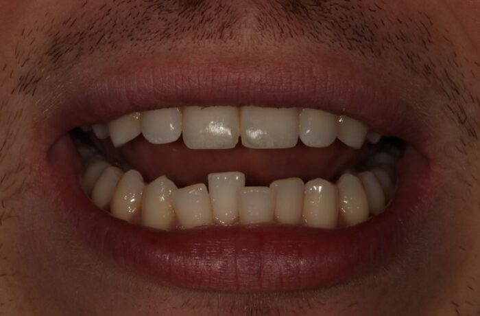 Before - Cheadle Hulme Dental