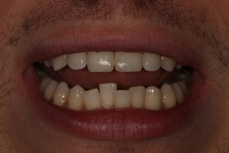 Before - Cheadle Hulme Dental