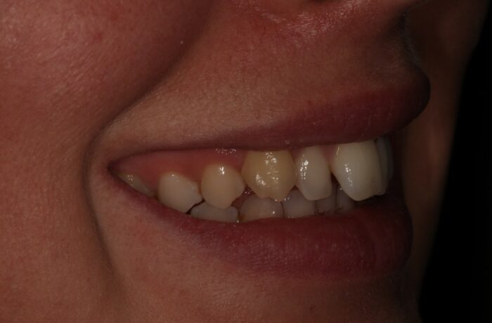Before - Cheadle Hulme Dental