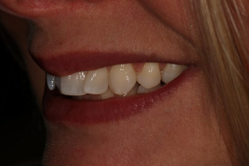 Before - Cheadle Hulme Dental