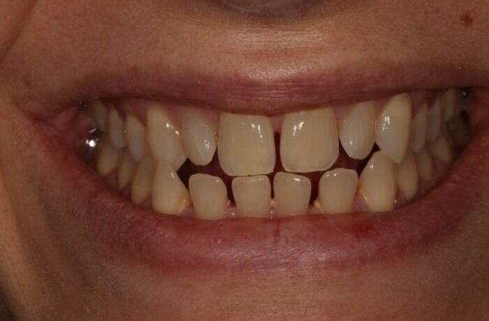 Before - Cheadle Hulme Dental