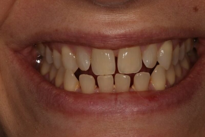 Before - Cheadle Hulme Dental