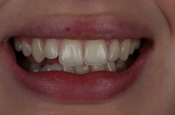 Before - Cheadle Hulme Dental