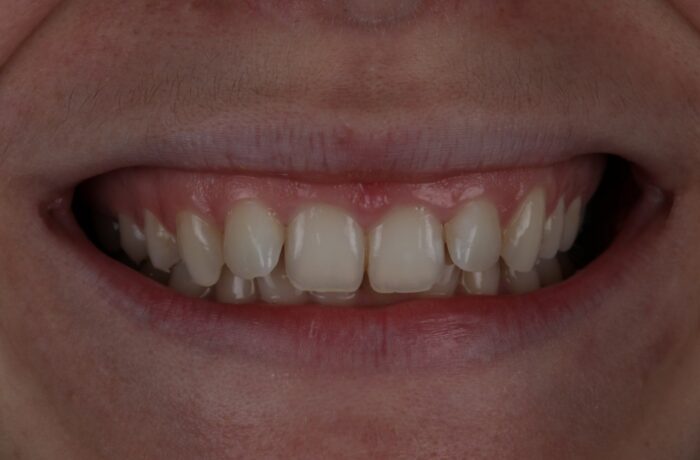 Before - Cheadle Hulme Dental