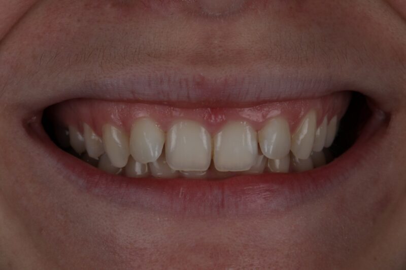 Before - Cheadle Hulme Dental