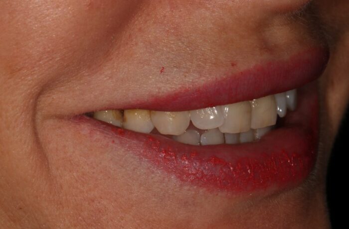 Before - Cheadle Hulme Dental