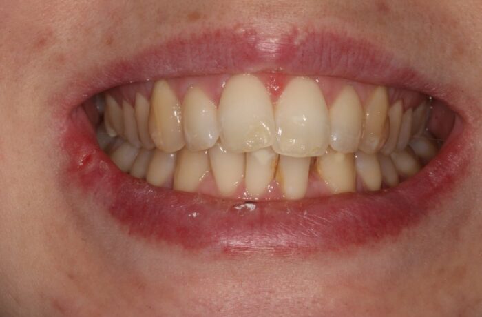 Before - Cheadle Hulme Dental