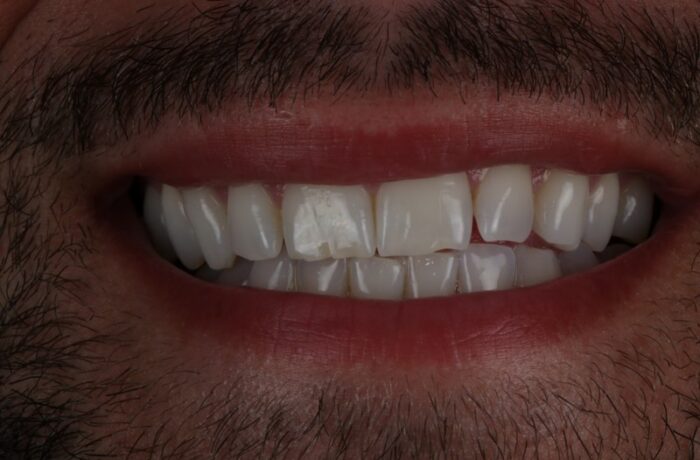 Before - Cheadle Hulme Dental