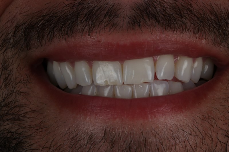 Before - Cheadle Hulme Dental