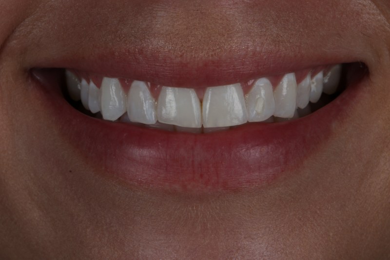 Before - Cheadle Hulme Dental