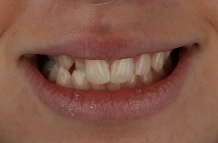 Before - Cheadle Hulme Dental