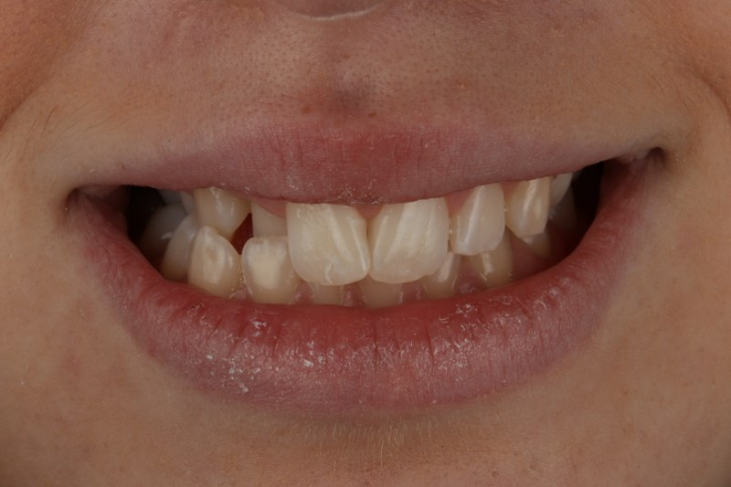 Before - Cheadle Hulme Dental