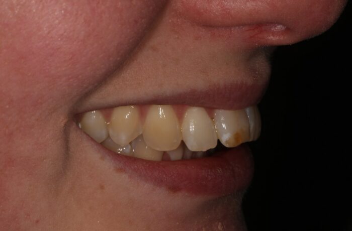 Before - Cheadle Hulme Dental