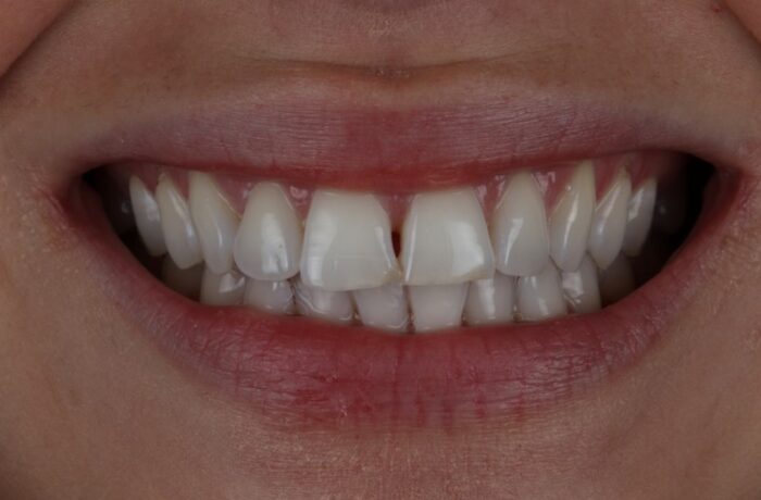 Before - Cheadle Hulme Dental