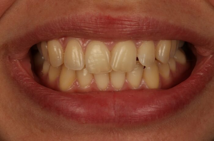 Before - Cheadle Hulme Dental