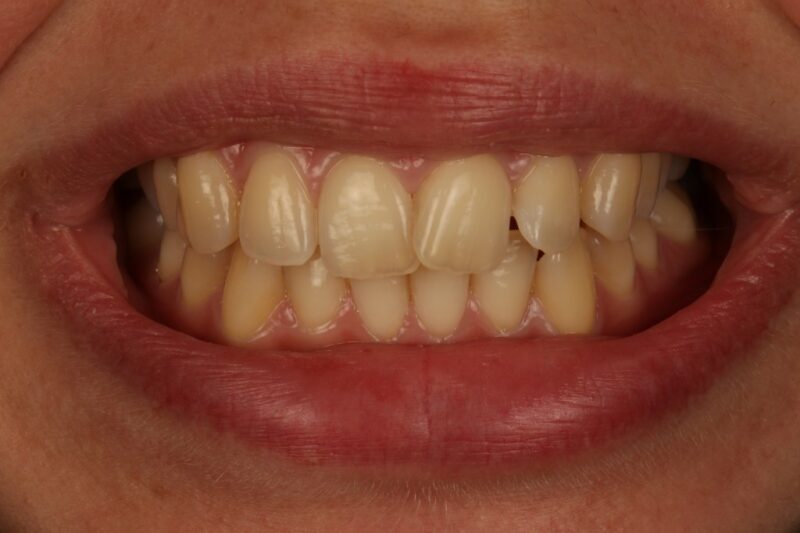 Before - Cheadle Hulme Dental