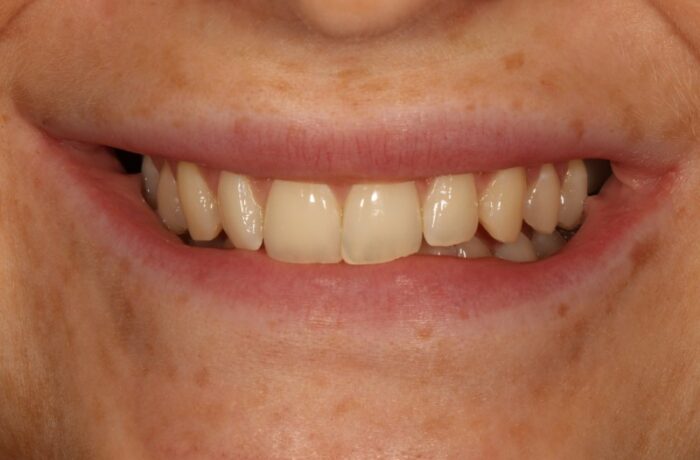 Before - Cheadle Hulme Dental