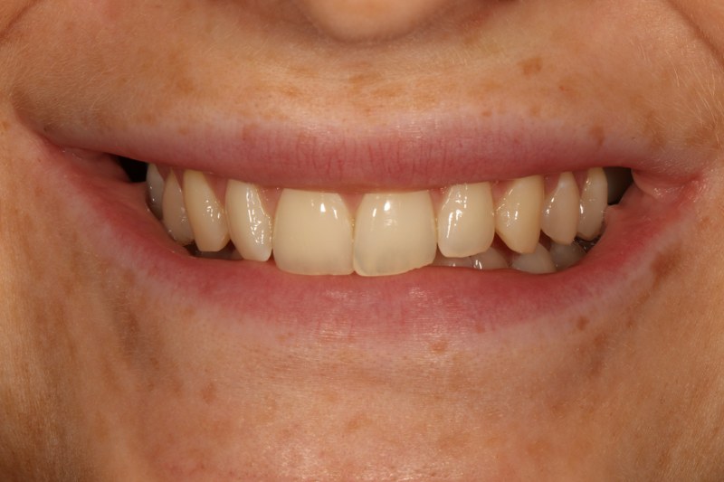 Before - Cheadle Hulme Dental