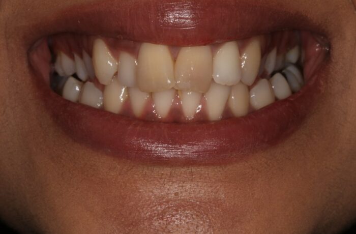 Before - Cheadle Hulme Dental