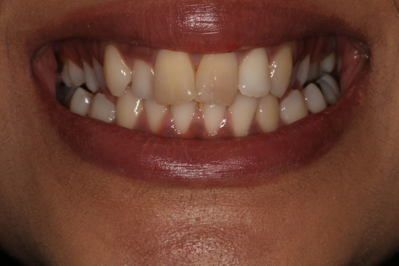 Before - Cheadle Hulme Dental