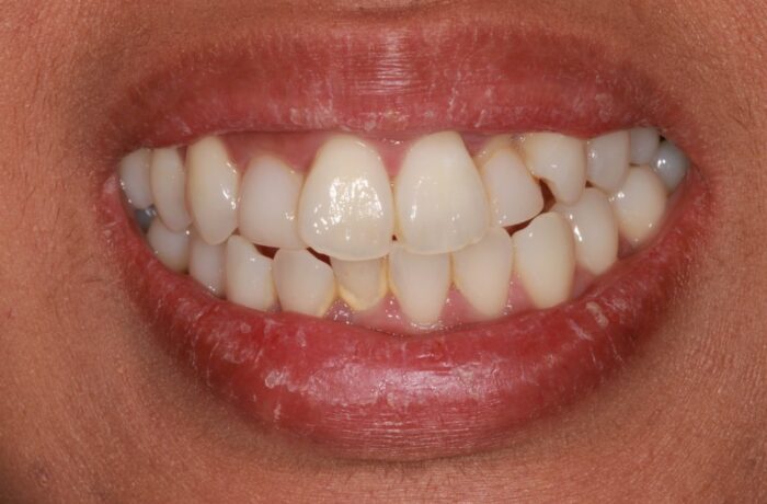 Before - Cheadle Hulme Dental