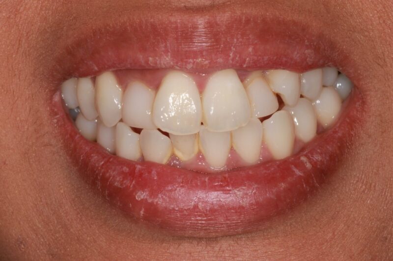 Before - Cheadle Hulme Dental