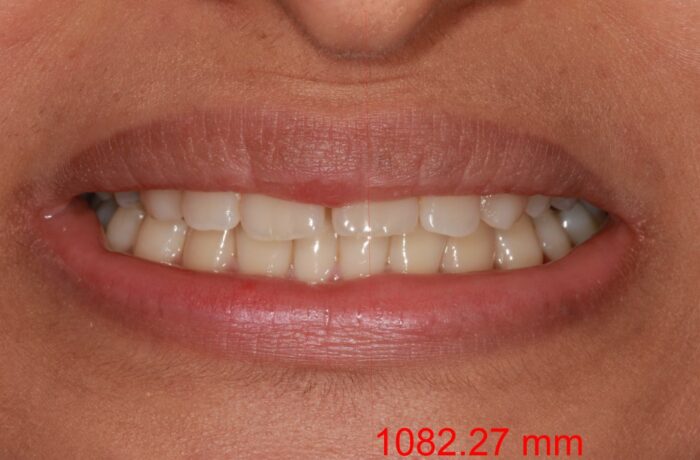 Before - Cheadle Hulme Dental