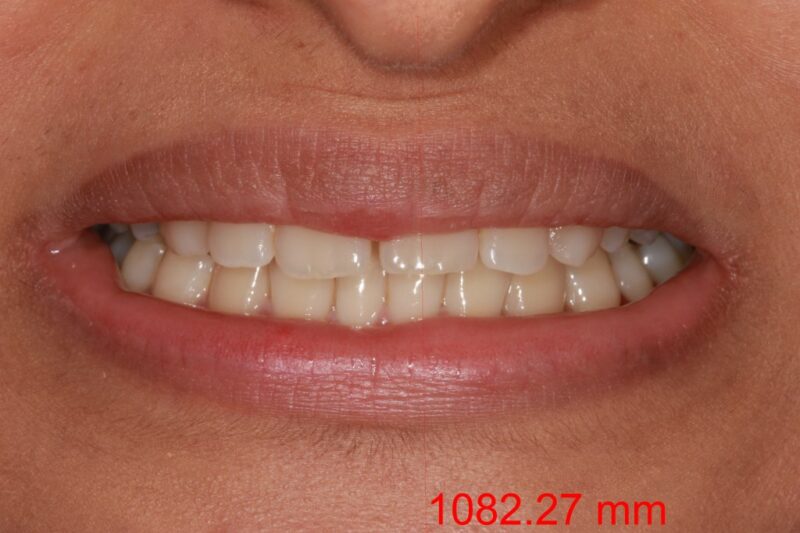 Before - Cheadle Hulme Dental