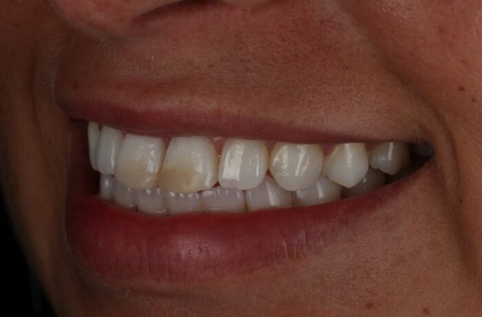 Before - Cheadle Hulme Dental