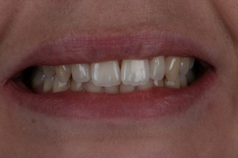 Before - Cheadle Hulme Dental