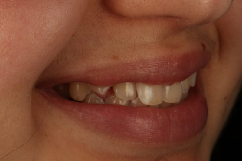 Before - Cheadle Hulme Dental