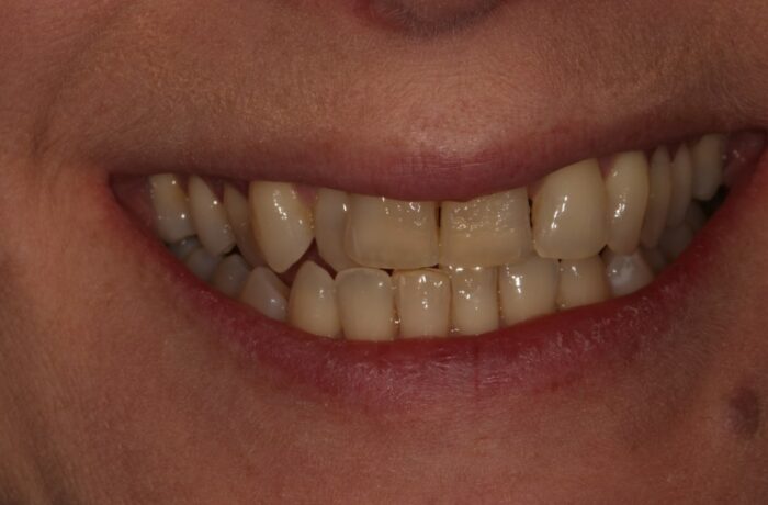Before - Cheadle Hulme Dental